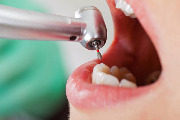Best Mobile Emergency Dentist in New Wilmington, PA